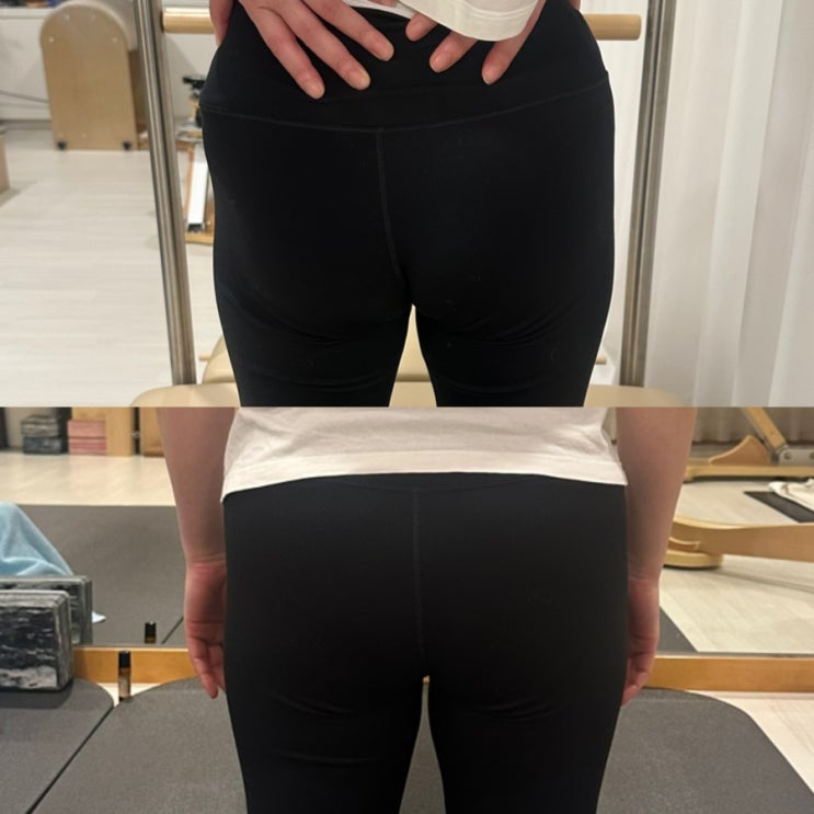 교대 골반 체형교정 후기